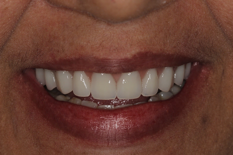 Foto 3 de Clínica OdontoSul Sp Grajaú