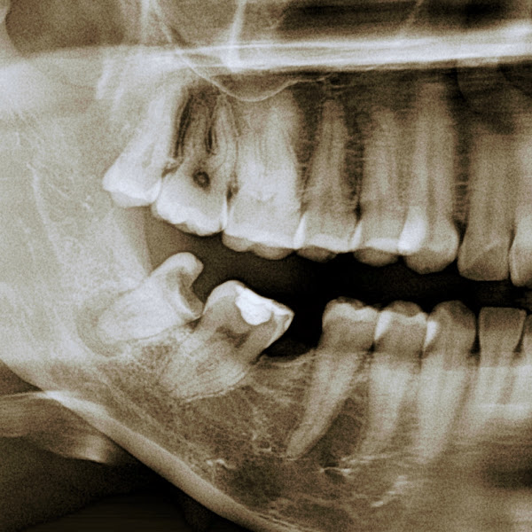 Foto 2 de CLÍNICA ODONTOVIEIRA