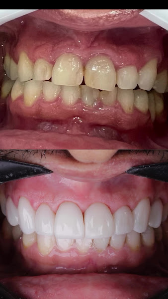 Foto 4 de Clínica Oral Dente Tratamentos Odontológicos | Dentista Recanto das Emas