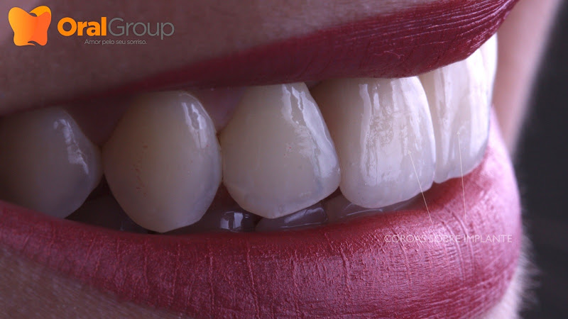 Foto 3 de Clínica Oral Group