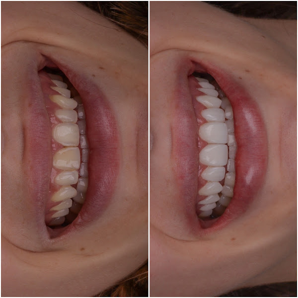 Foto 2 de Clínica OralDent (Dentista em Bragança Paulista)