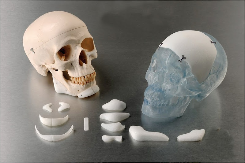 Foto 3 de Clínica OroFaciall - Dr. Jorge Fernandes - Implantes Faciais