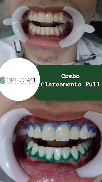 Foto 3 de Clínica Orthoface