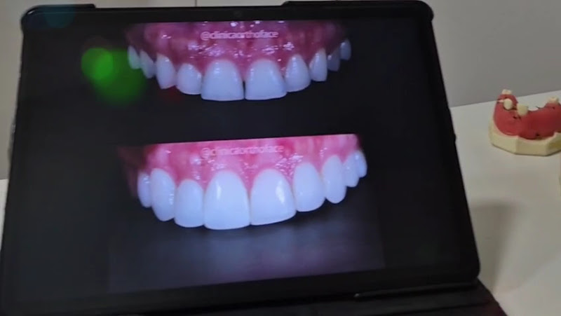 Foto 4 de Clínica Orthoface