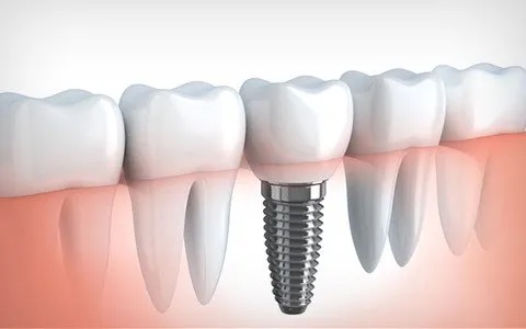 Foto 3 de Clínica OrtoCentter