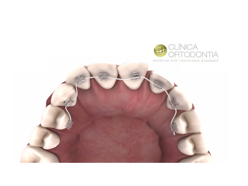 Foto 3 de Clínica Ortodontia | Estética com Tecnologia Avançada