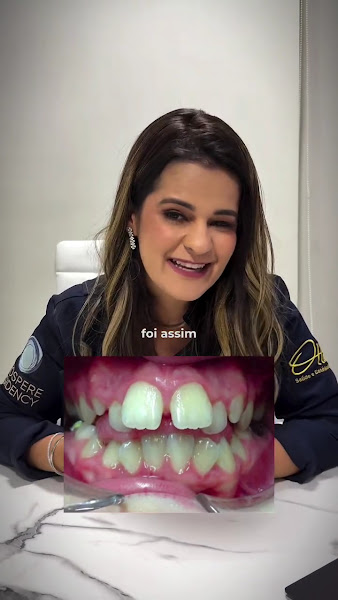Foto 3 de Clínica Ottimi – Invisalign | Implantes | Protocolo | Clínica Odontológica | Dentista na Vila Olímpia, Itaim Bibi e Moema