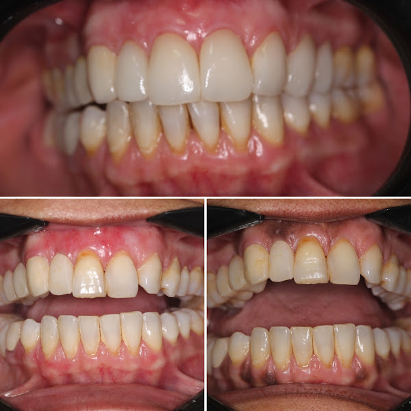 Foto 2 de CLÍNICA OTTOBONE