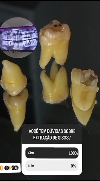 Foto 4 de Clínica Para Sorrir