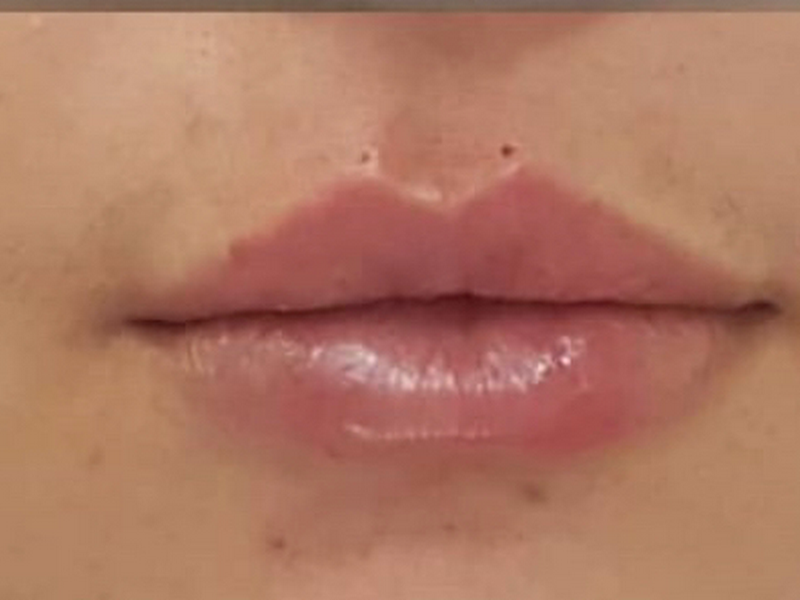 Foto 9 de Clínica Rabelo & Sena Odontologia/ Ortodontia/ Dentista em Curitiba