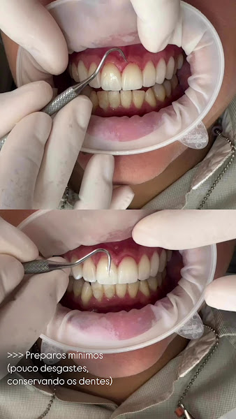 Foto 4 de Clínica Rafaela Araújo - Especialista em Reabilitação - Maceió/AL