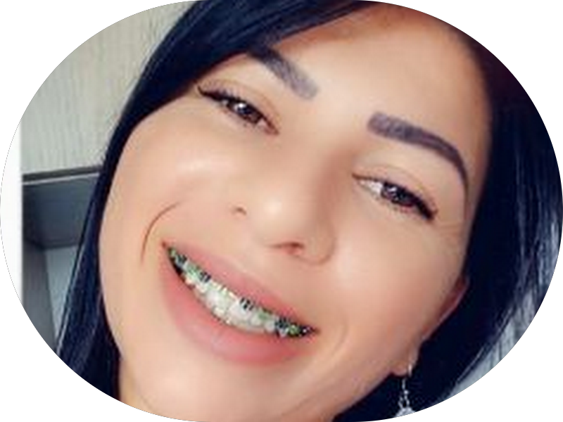 Foto 6 de Clinica Rafaela Winter - Odontologia Especializada e Harmonização Facial