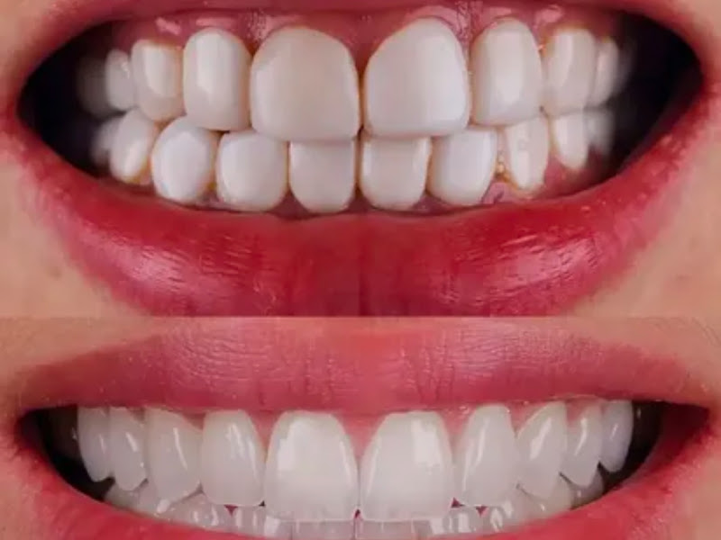 Foto 3 de Clinica Reabilit Odontologia - Camping Club