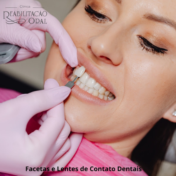 Foto 3 de Clínica Reabilitação Oral - Dr. Sérgio Dantas Dentista