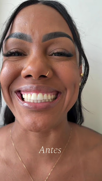 Foto 3 de Clínica Realiies - Dra Samara Neves | Implantes Dentários, Salvador