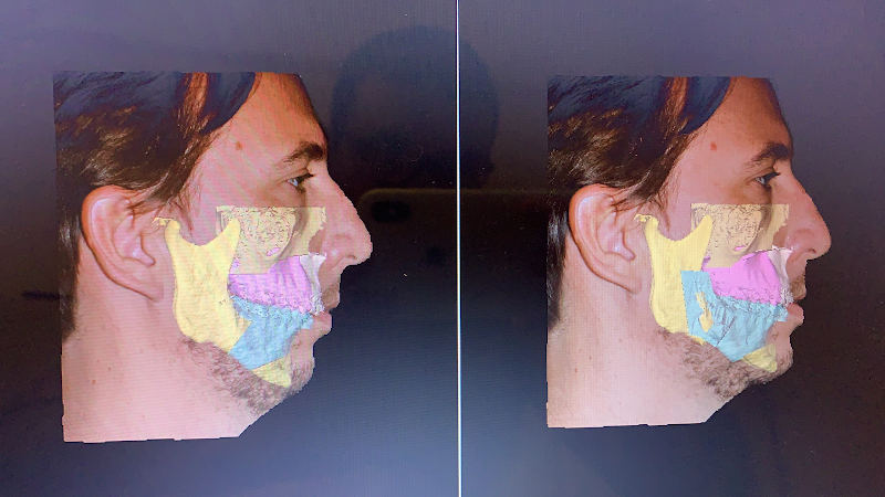 Foto 3 de Clínica Realize - Harmonização Facial - Salvador