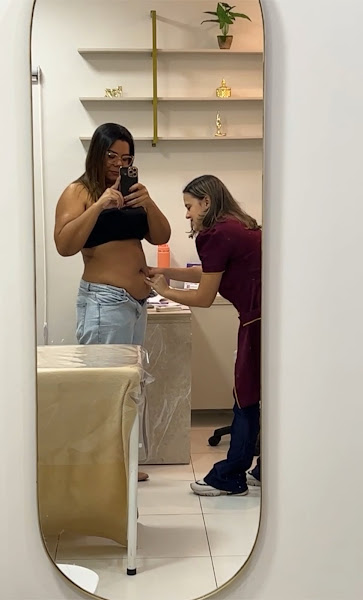 Foto 2 de Clínica Rebeca Vaz | Criolipólise, Limpeza de pele, Ozonioterapia, Redução de medidas em Parnaíba PI