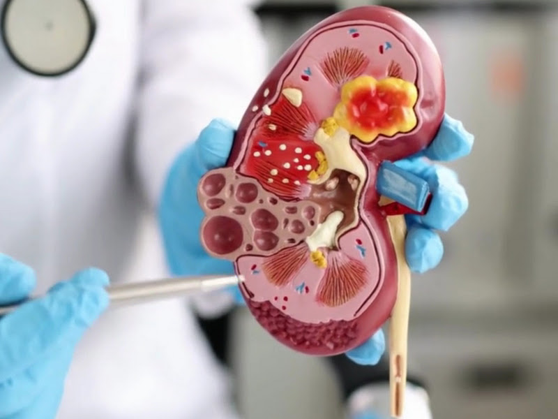 Foto 3 de Clínica Renal de Luziânia