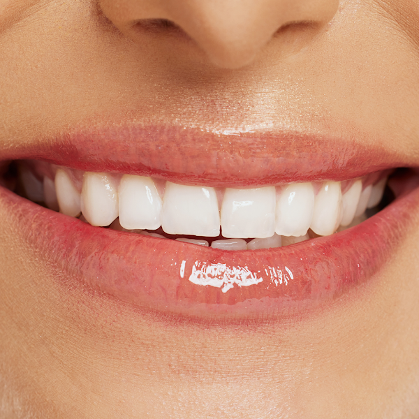 Foto 3 de Clínica Rennove Up - Dra Vanessa Ornellas - Odontologia e Medicina Integrativa