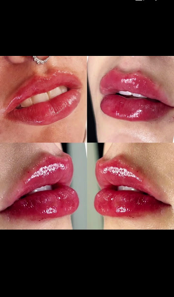 Foto 2 de Clínica Revati odontologia e Estética