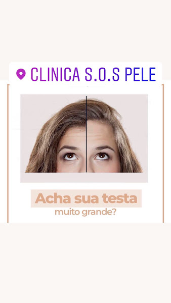 Foto 2 de CLÍNICA S.O.S Pele & Cabelos (DRA BÁRBARA CHAVES)