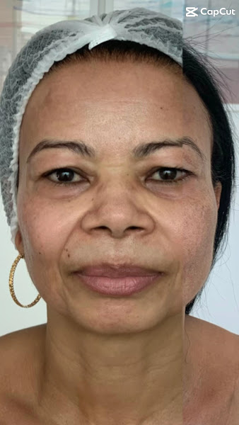 Foto 2 de Clinica Senna - Limpeza de Pele e Tratamento de Melasma em Alagoinhas | Nutricionista em Alagoinhas
