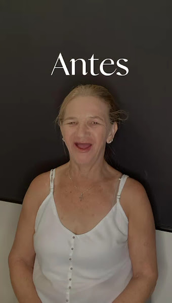 Foto 3 de Clínica Silveira Odontológica - Especialistas em implantes e protocolos