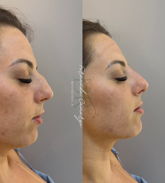 Foto 2 de Clinica Sky face