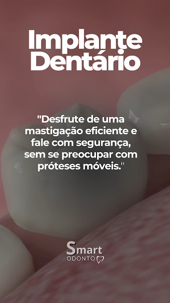 Foto 3 de Clínica Smart Odonto