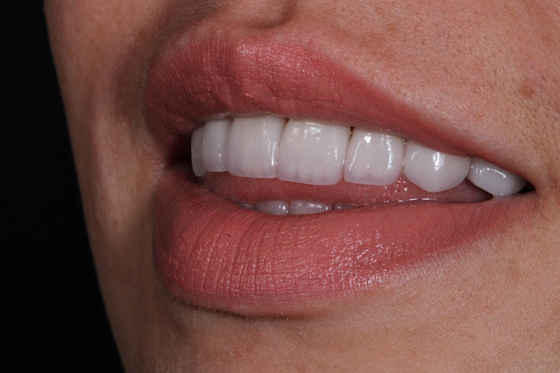 Foto 2 de Clínica SmartDent | Dentista Taboão da Serra