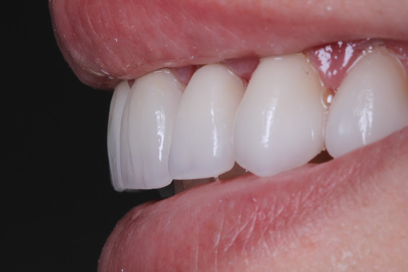 Foto 3 de Clínica SmartDent | Dentista Taboão da Serra