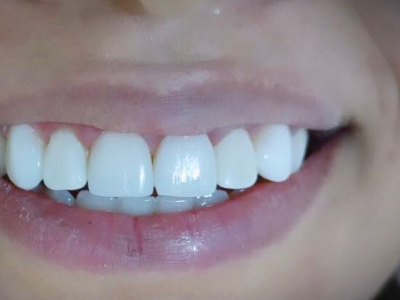 Foto 4 de Clínica Solon Galvão Reabilitação Oral