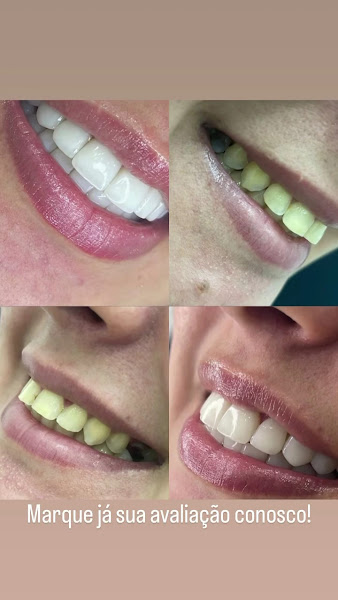 Foto 3 de Clínica Sorria de novo - |Melhor Clínica odontológica de Santo André|, |Dentista em Santo André| (Sob Nova Direção)