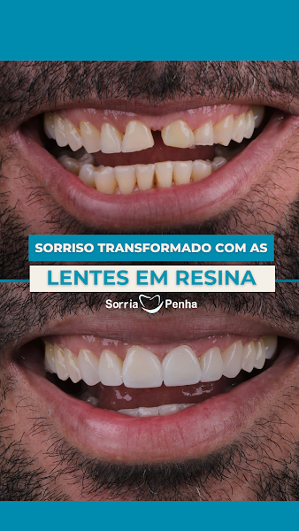 Foto 3 de Clinica Sorria Penha - Unidade Penha