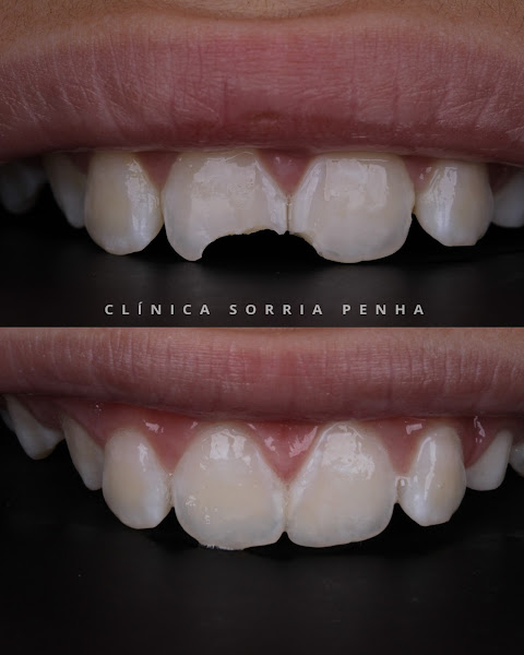 Foto 5 de Clinica Sorria Penha - Unidade Penha