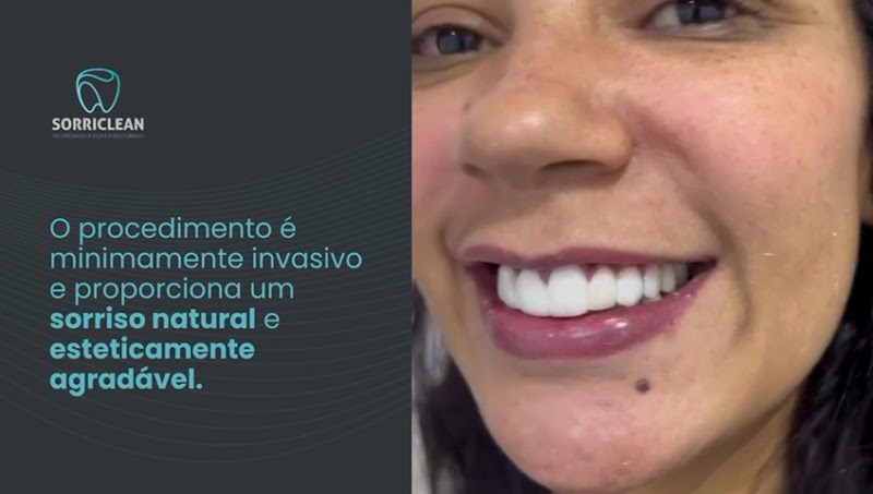 Foto 4 de Clínica Sorriclean