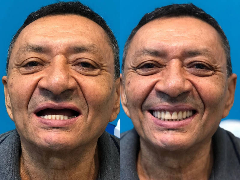 Foto 9 de Clínica Sorridents Aracaju: Dentista, Invisalign, Implantes Dentários e Aparelho Dental