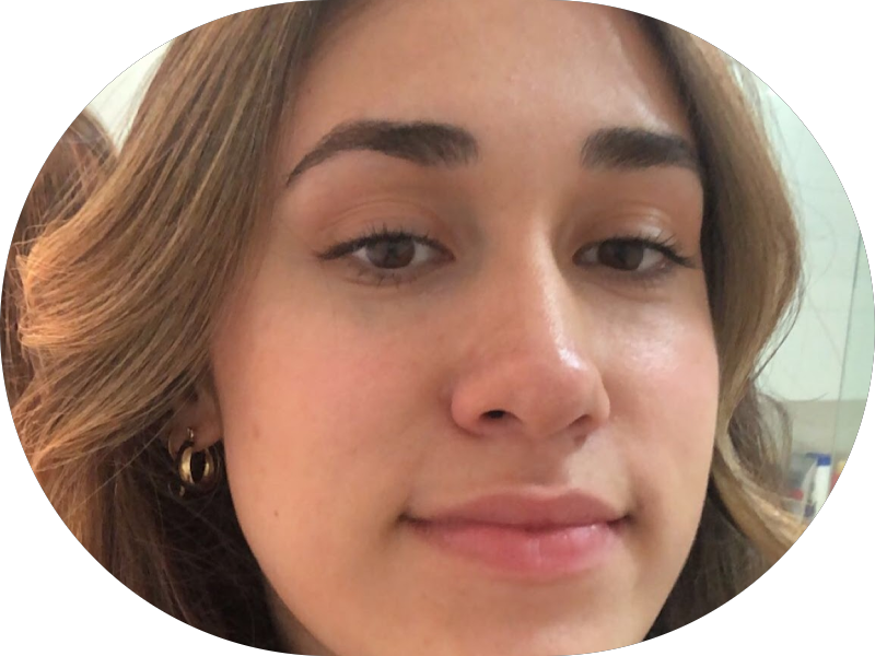 Foto 5 de Clínica Sorrindo Odontologia Estética Invisalign Implante Dentário Lentes Contato Dental Botox Ronco Apneia ATM