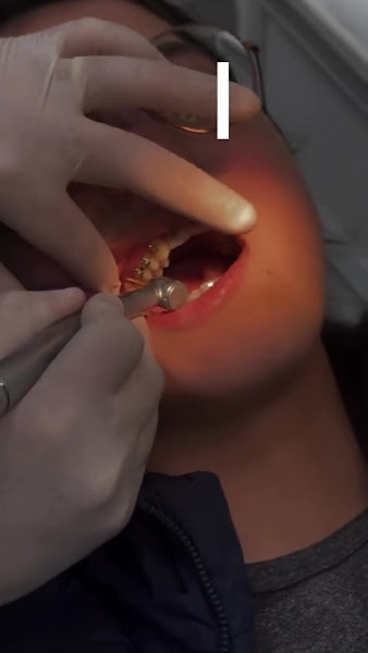 Foto 3 de Clínica Sorrinova Odontologia Bento Gonçalves