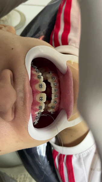 Foto 3 de Clínica Sorriso Fixo