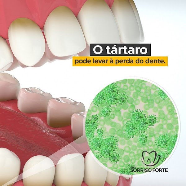 Foto 3 de Clínica Sorriso Forte | Dentista em Parauapebas - PA