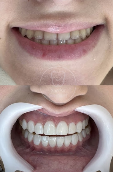 Foto 3 de Clínica Sorriso Saudável