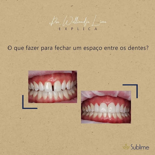 Foto 3 de Clínica Sublime Saúde Integrada - Facetas - Invisalign - Implantes