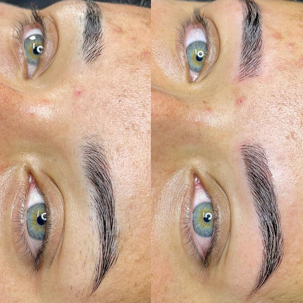 Foto de Clínica Suelen Szendela - Estética Avançada e Micropigmentação