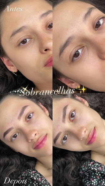 Foto 2 de Clínica Suelen Szendela - Estética Avançada e Micropigmentação