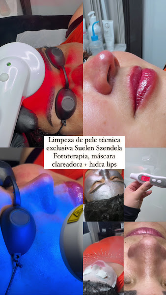 Foto 3 de Clínica Suelen Szendela - Estética Avançada e Micropigmentação
