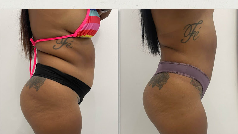 Foto 2 de Clínica Tatiane Fernandes Estética Personalizada