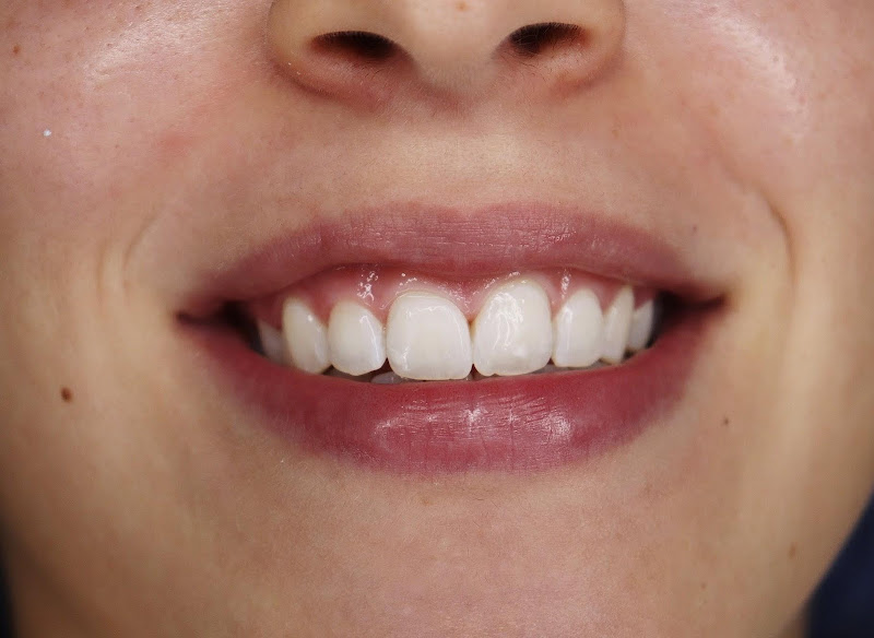 Foto 2 de Clínica Teresa Longo - Ortodontia e Ortopedia Facial - Invisalign Doctor