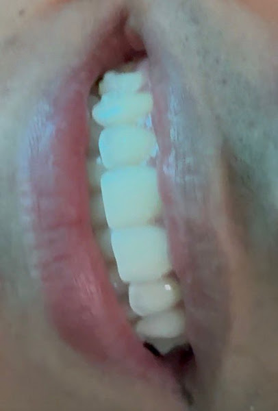 Foto 3 de Clínica Teresa Longo - Ortodontia e Ortopedia Facial - Invisalign Doctor