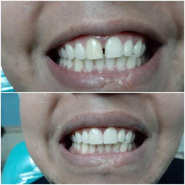 Foto 3 de Clínica UniSorriso - Dentista em Embu das Artes